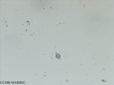 phyto/Scattered_Islands/iles_glorieuses/SIREME May 2016/Gonyaulax sp8 (ancien Dino 38 -cf Amphidoma sp ou Centrodinium sp ou Gonyaulax-SIREME-Glorieuses2016-GLO5surf-51016-scrieppsiella1-2)(copy)_thumb.jpg